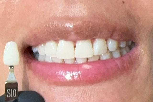 Results