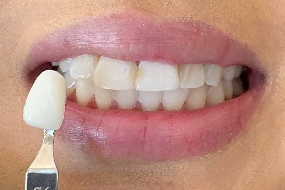 Results