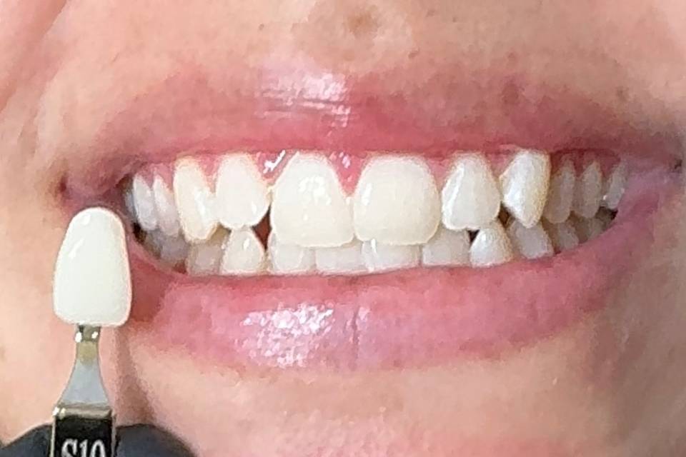 Results