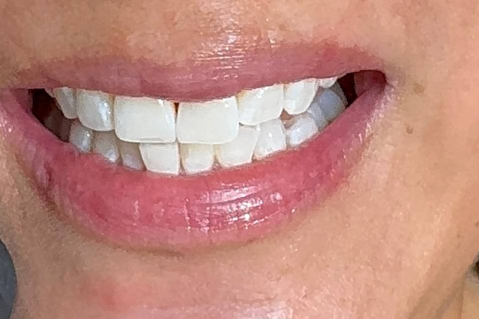 Results