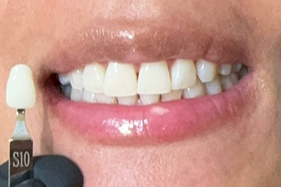 Results