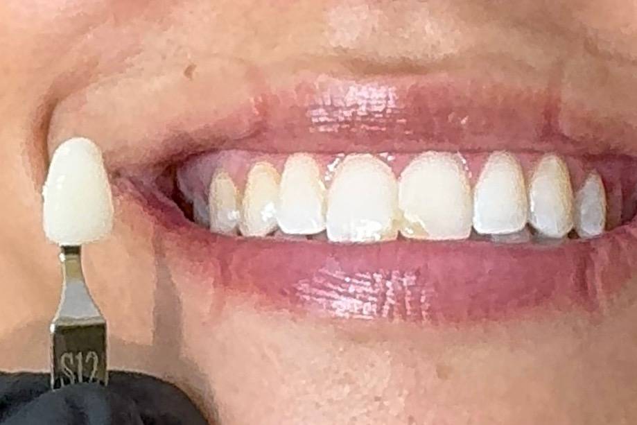 Results