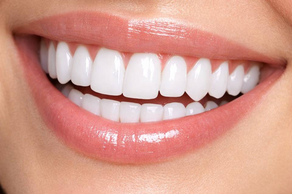 Vibrant Teeth whitening