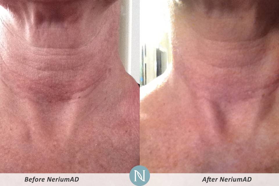 Nerium International