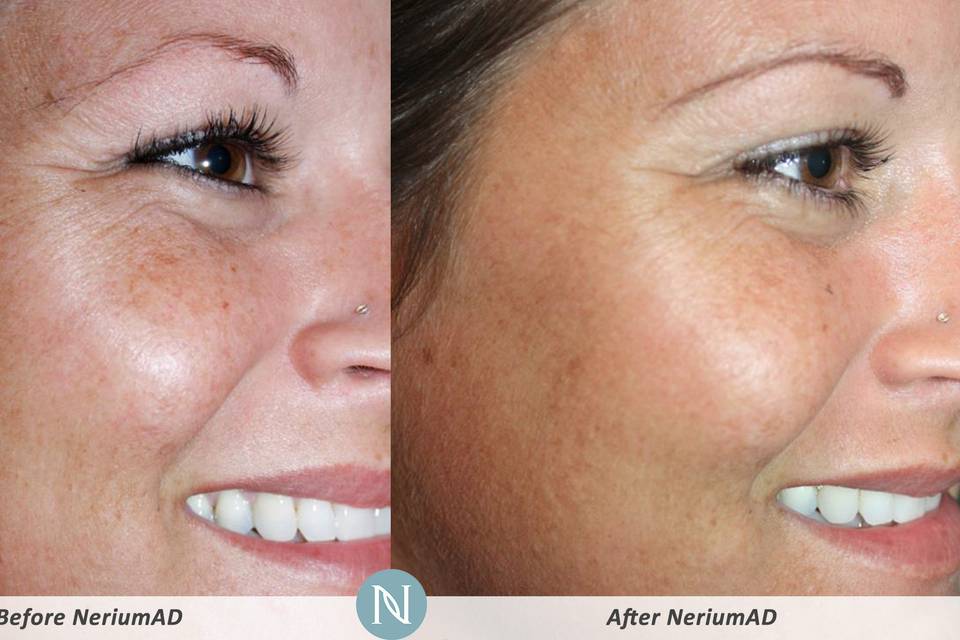 Nerium International