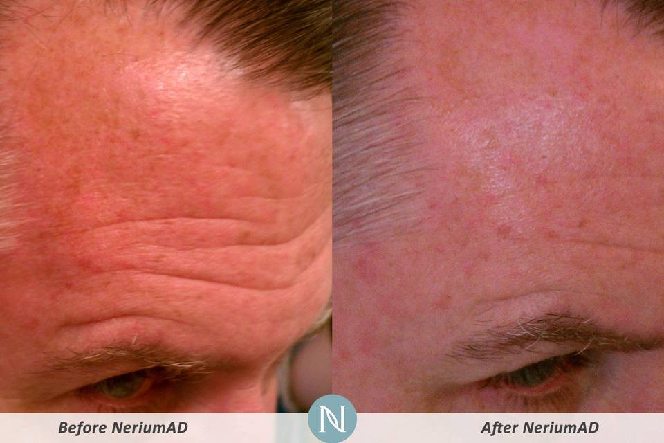 Nerium International