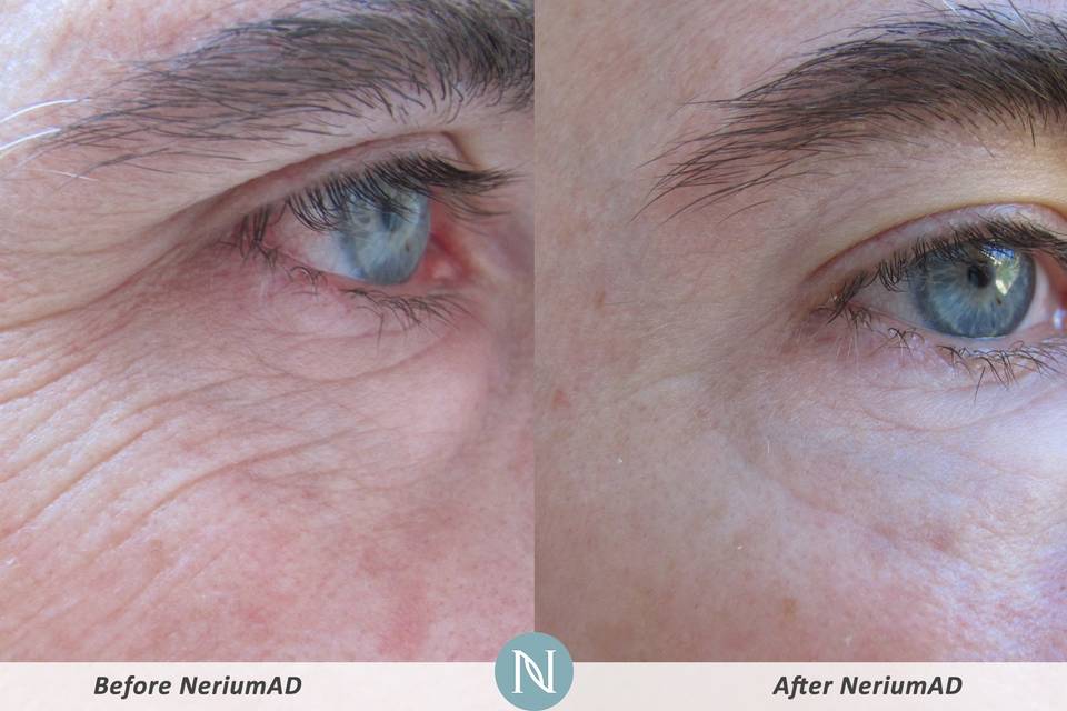 Nerium International