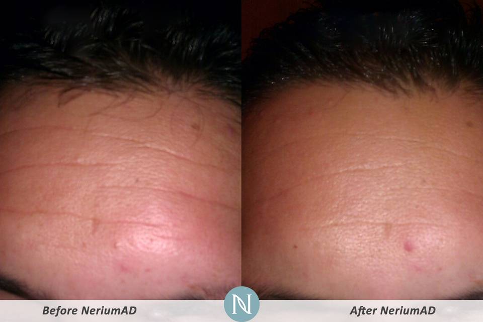 Nerium International