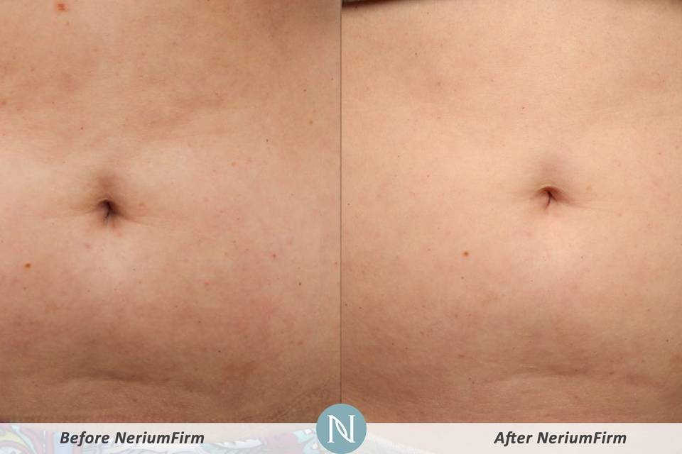 Nerium International