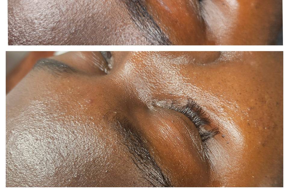 Glow-up facial