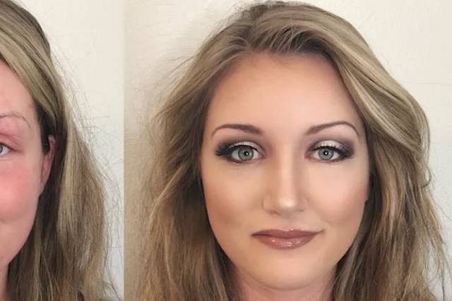 Before/After