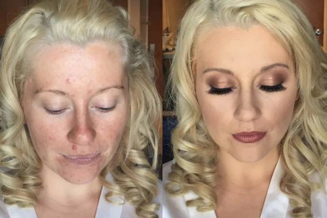 Before/After