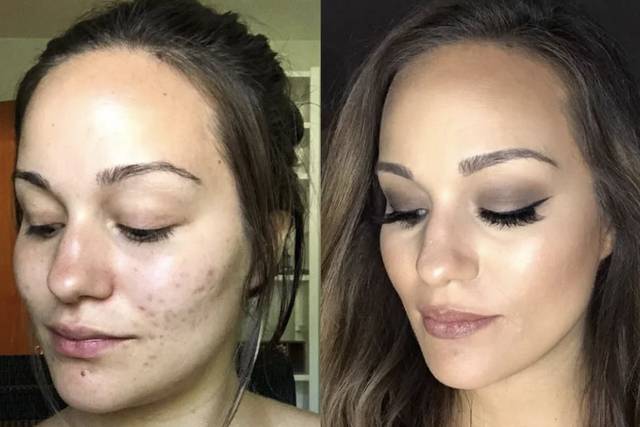 Before/After