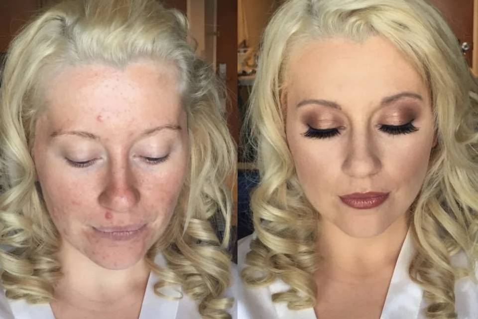 Before/After