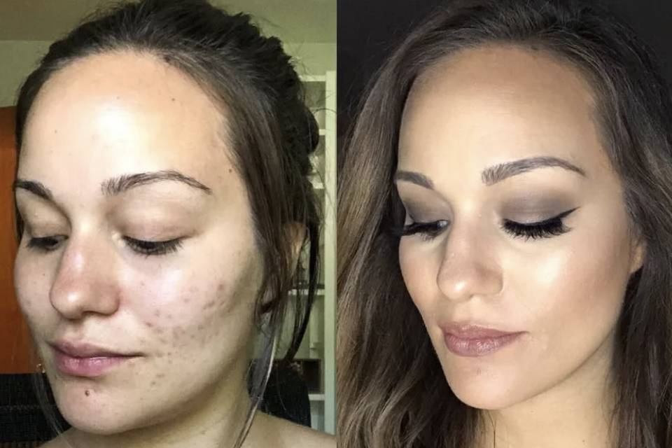 Before/After