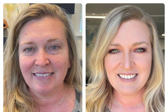 Before and after natural look