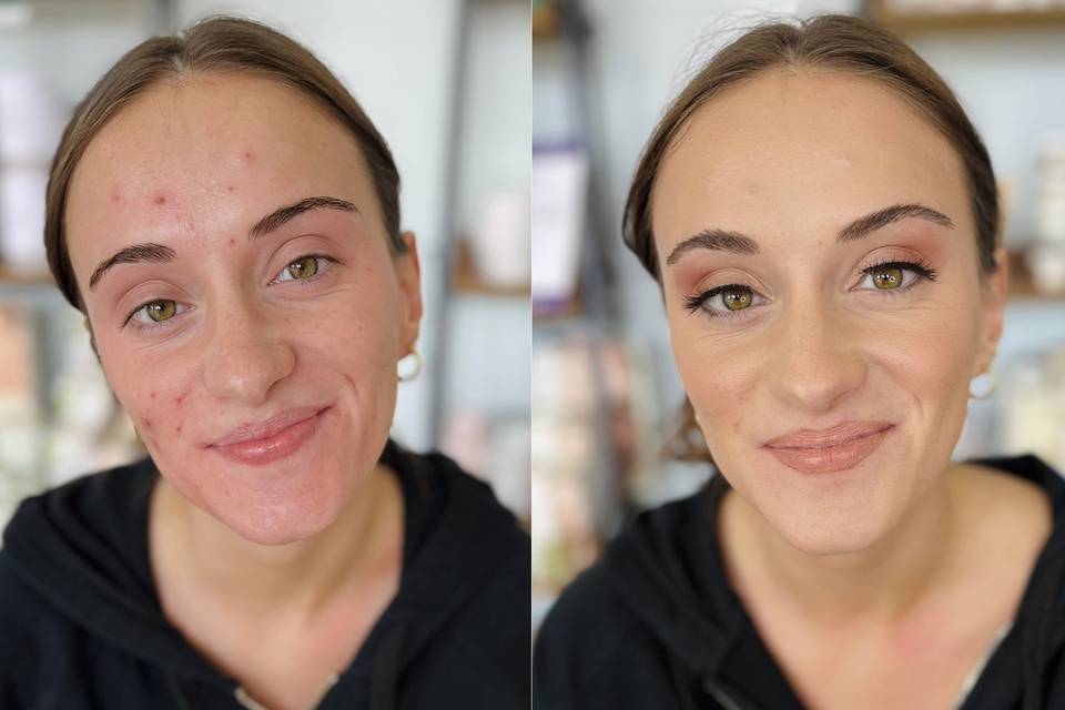 Radiant Look Before & After