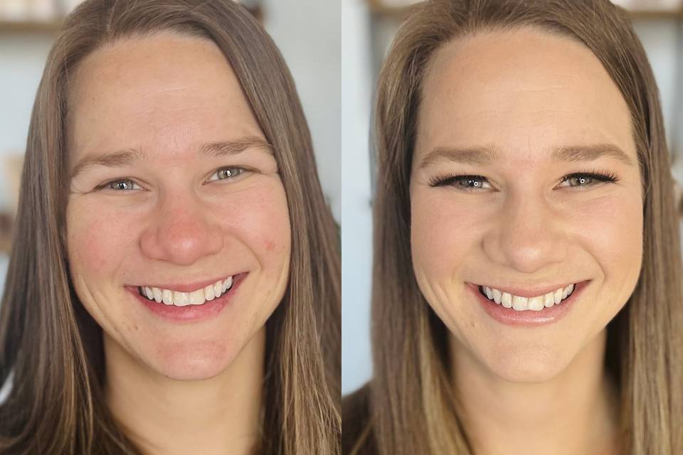 Natural Look Before & After