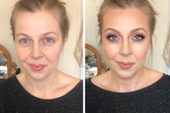 Before and After