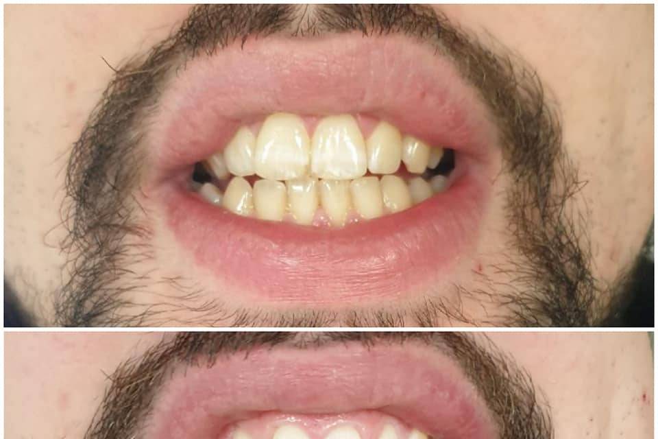 Client