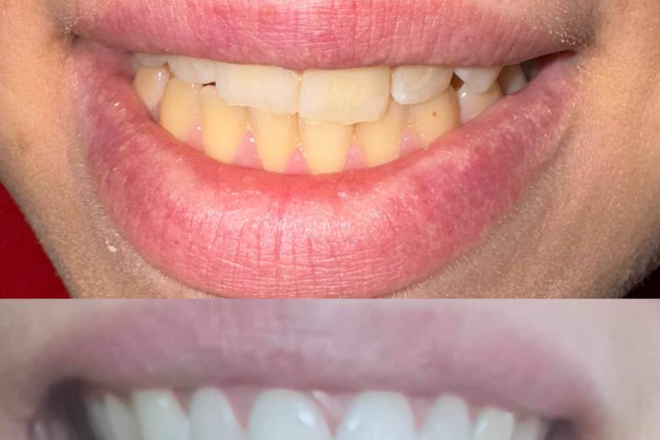 Before & After