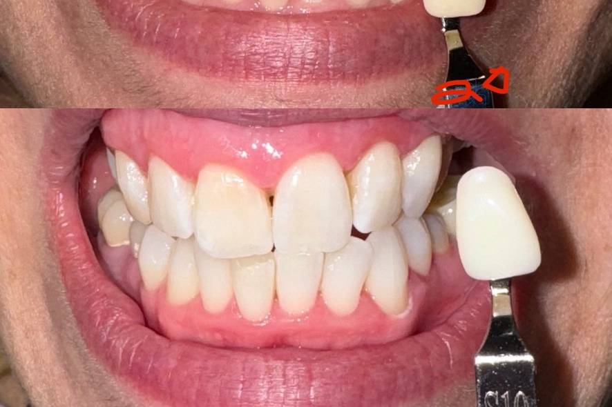 Client Before and After