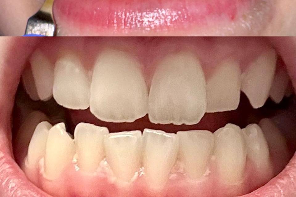 Before & After