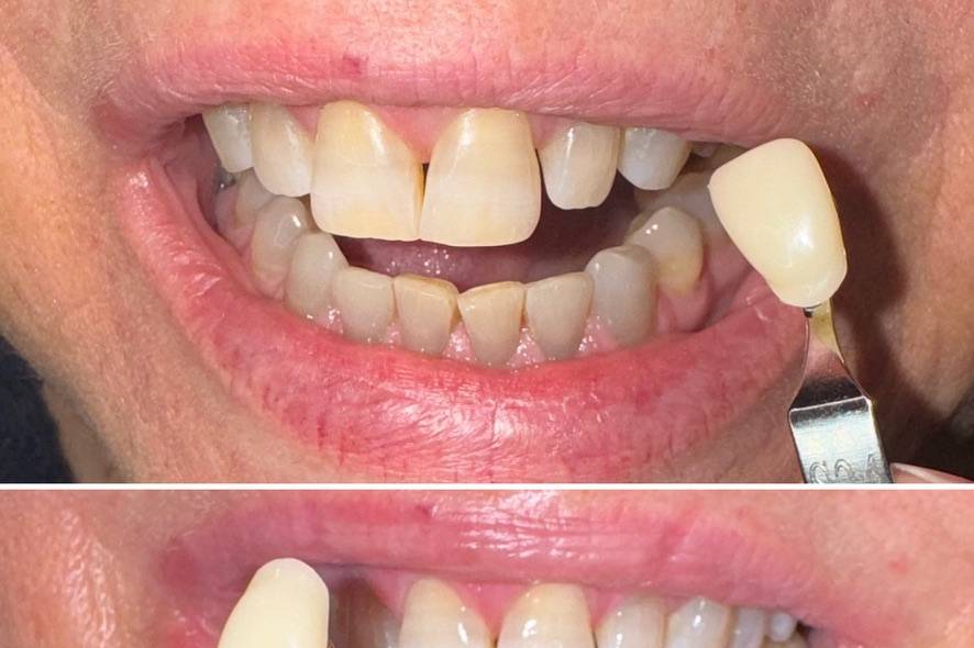 Client Before and After