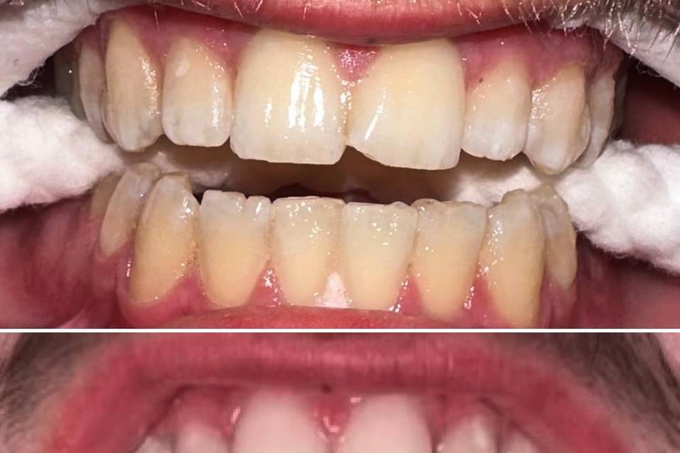 Teeth