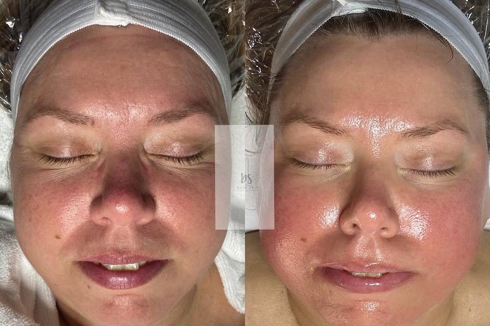 Bare Skin Facial and Waxing Studio