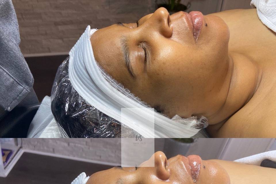 Bare Skin Facial and Waxing Studio