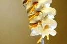 Chiropractic