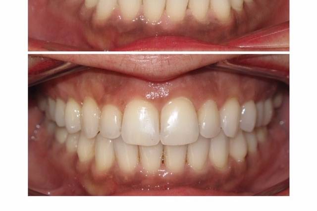 Gerlein Orthodontics
