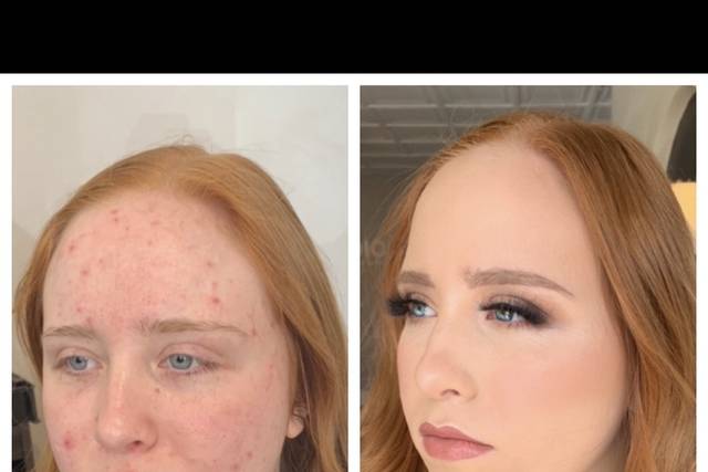 Before and after