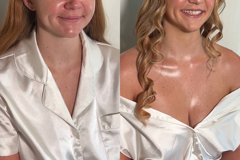Wedding B&A