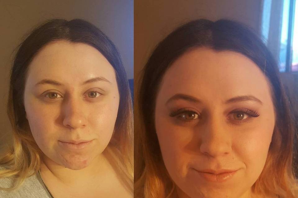 Before and after