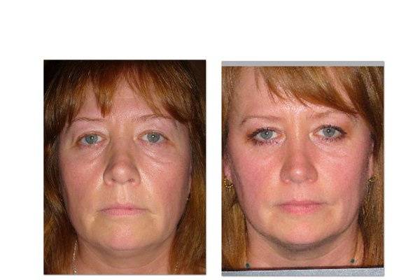 STOP AGING NOW