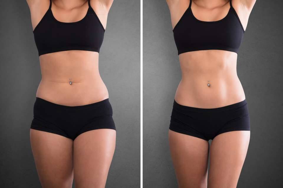 New Jersey Trim Clinic