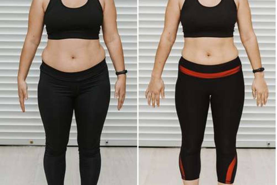 New Jersey Trim Clinic