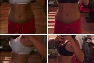 Treatment with the Zerona laser is easy, painless, and carefree. Each session takes less than an hour