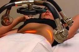 Through a double blind, randomized, multi-site and placebo-controlled study, the Zerona procedure is proven to be an effective non-invasive and body contouring procedure. On average, patients lost on average 3.64 inches from the circumference of their waist, hip and thighs, whereas the placebo group only lost an average of a half of an inch.
