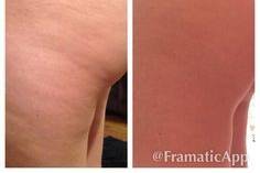 60 day results with our firm lotion twice a day with no special diet or exercise!!