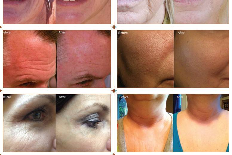 Collection of results with our night cream!!