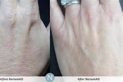 Our night cream does miracles for your hands as well!! 1 week results!!