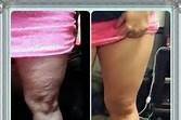 60 day results with our firm lotion applied twice a day and no special diet or exercise!!