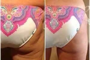 60 day results with our firm lotion applied twice a day with no special diet or exercise!!