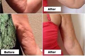 90 day results using our firm lotion twice a day!!