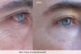 ONLY 4 days of our night cream!!  Amazing!!