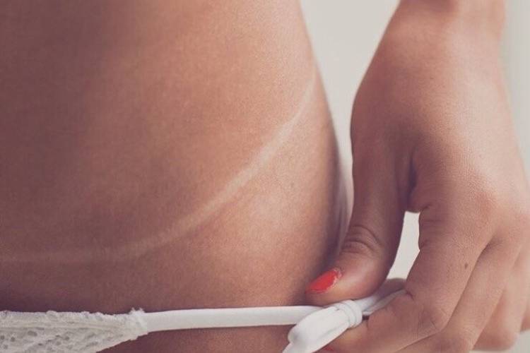 TAn line