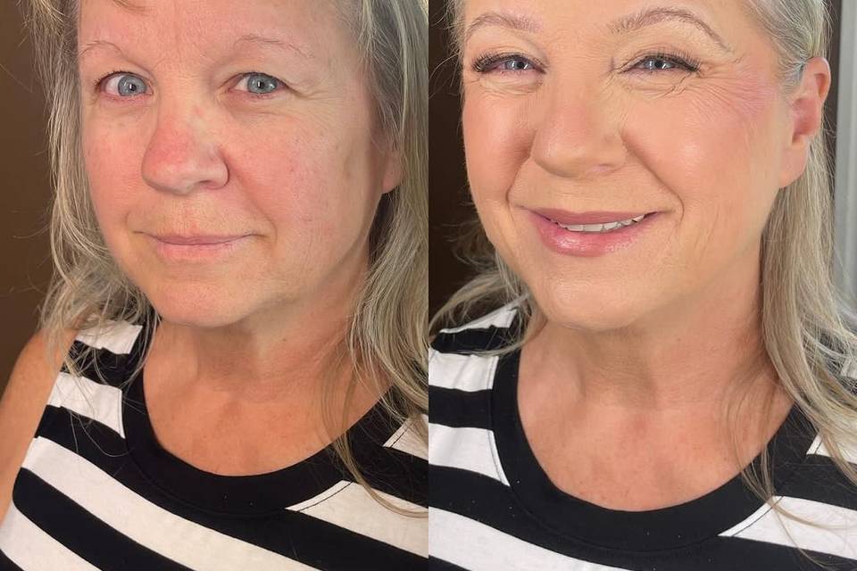 Before & After Mature Skin